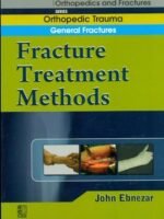 Fracture Treatment Methods (Handbook In Orthopedics And Fractures Vol.02 - Orthopedic Trauma General Fractures)