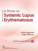 A Primer on Systemic Lupus Erythematosus