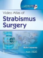 Video Atlas of Strabismus Surgery