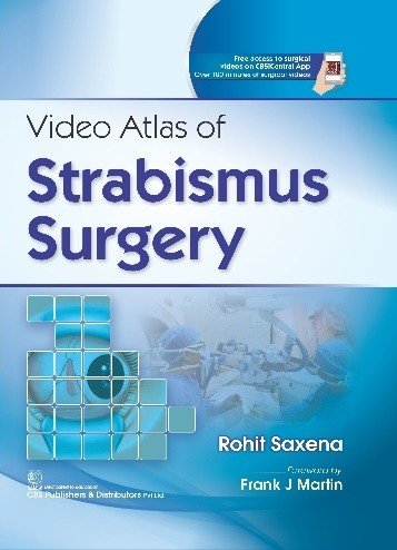 Video Atlas of Strabismus Surgery