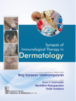 Synopsis of Immunological Therapy in Dermatology