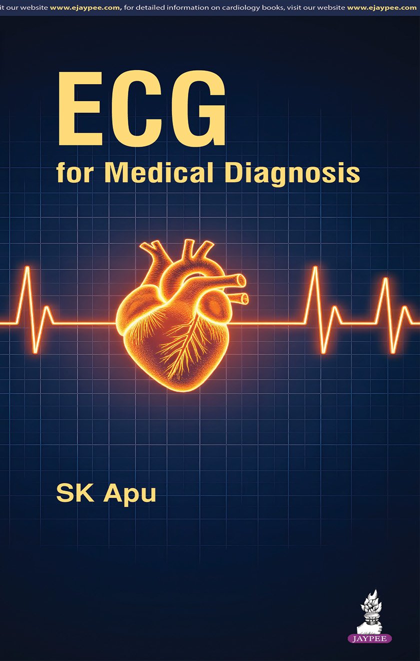 ECG for Medical Diagnosis